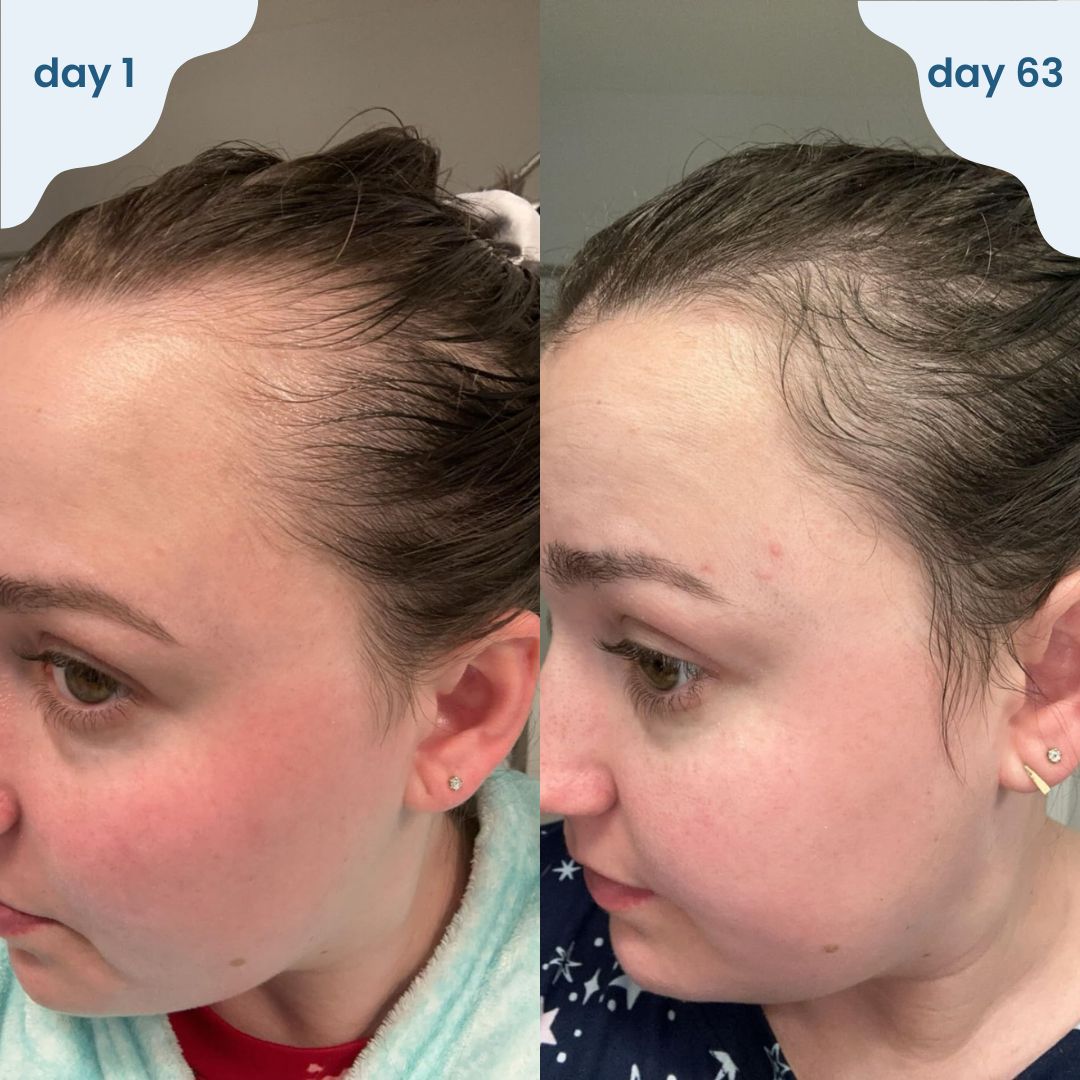 Bloomy - hair regrowth stick