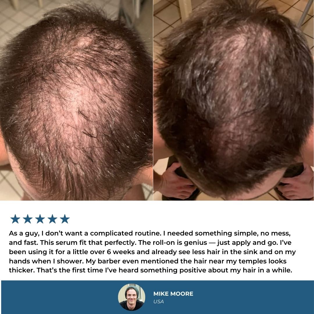 Bloomy - hair regrowth stick