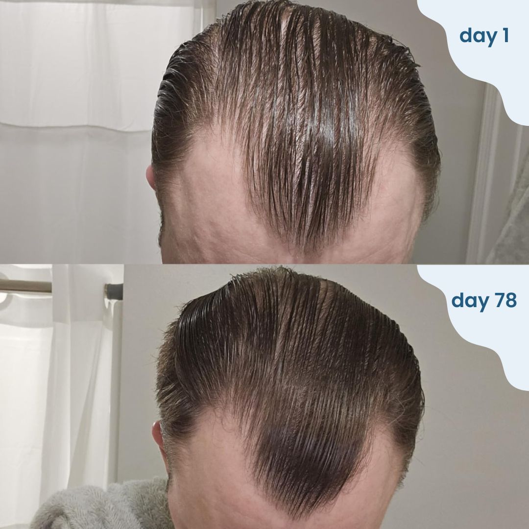 Bloomy - hair regrowth stick
